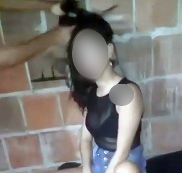 mulher-agredida Suspeito é preso em caso de mulher que tem cabelo arrancado a faca
