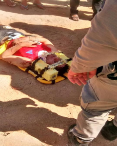 acidente-monteiro-Copy-240x300 Em Monteiro: Homem fica ferido após perder o controle de motocicleta