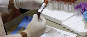 naom_56abb09db1375-300x129 Vacina contra zika será testada em humanos até o fim do ano