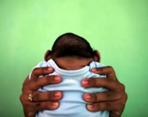 bebe-310x245-300x237 Brasil soma 2 mil casos de microcefalia em 1 ano; PB é o 3º estado com maior número de vítimas