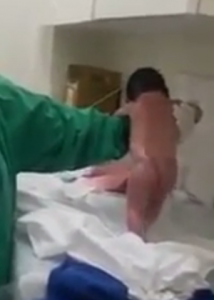 bebe-sai-andando-apos-parto--214x300 Bebê "sai andando" logo após o parto e vídeo viraliza; pediatra explica a cena