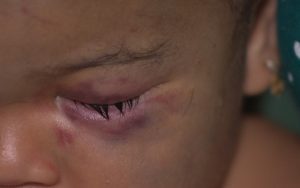 crianca-suspeita-de-maus-tratos-300x188-300x188 Mãe confessa ter agredido filho de 11 meses que teve traumatismo craniano