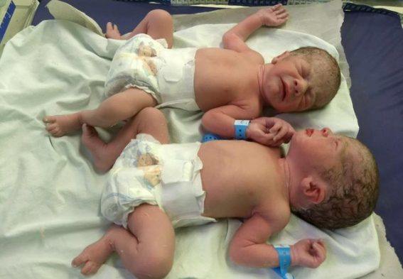 irmaos-gemeos-juntos-567x393 Gêmeos ficam de mãos dadas após parto e comovem equipe médica