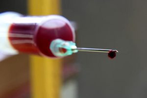 1518116658457-seringa-aids-300x200 Curandeiro infecta dezenas com HIV ao usar mesma seringa