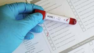 h1n1-1 Resultado de exame descarta suspeita de morte por H1N1 em cidade do Cariri