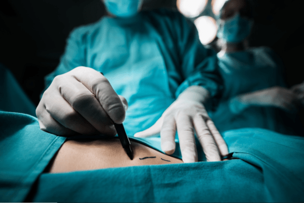 cirurgia_-_medico-599x400 Municípios paraibanos receberão repasse de R$ 4,7 milhões para realizar cirurgias eletivas