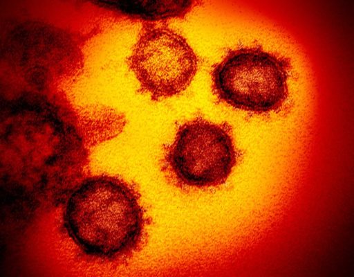 coronavirus-visao-microscopio-512x400 Exames descartam mais dois casos de coronavírus na Paraíba, diz secretaria
