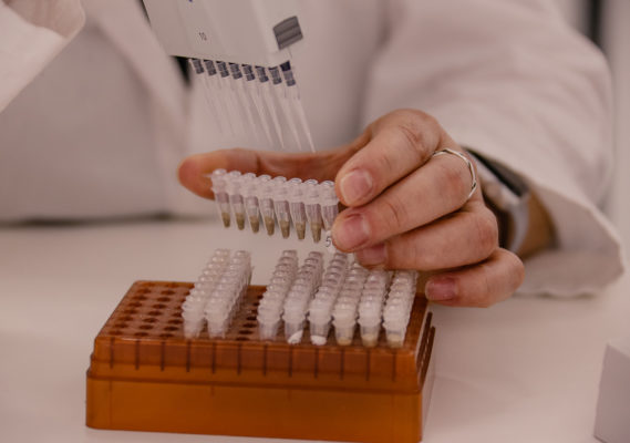 testes-pb-569x400 PB terá 812 mil testes rápidos para detectar coronavírus
