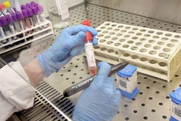 virus-599x400 76 exames analisados pelo Instituto Evandro Chagas testam negativos para Covid-19, diz Secretaria de Saúde da PB