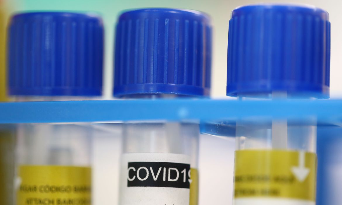 coronavirus-swiss-lab Suíça restringe visitantes do Brasil e de mais 28 países
