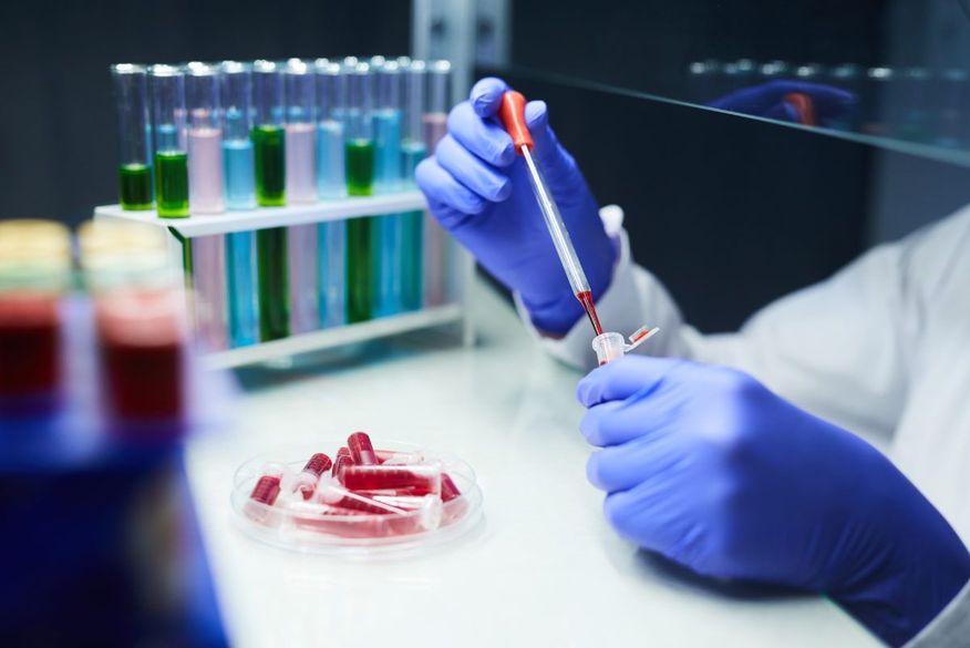 test-in-laboratory-z5der42-scaled-1 Paraíba confirma 624 novos casos de Covid-19 em 24h; total de mortos chega a 1.477 e 66.971 infectados