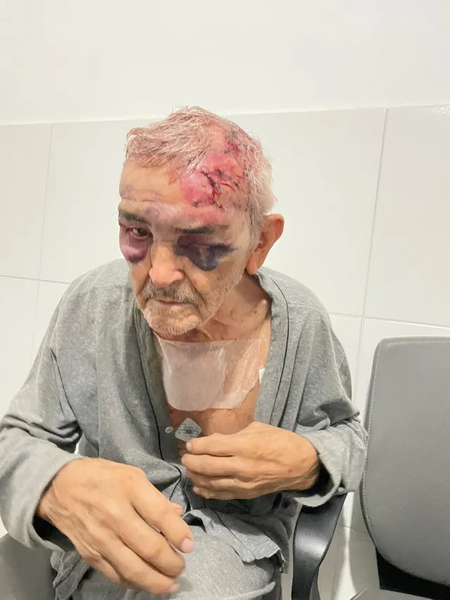 whatsapp-image-2022-09-02-at-5.01.42-pm Idoso de 86 anos é espancado com barra de ferro durante assalto na PB