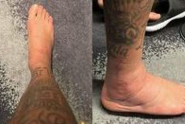 neymar_tornozelo_copa_catar_foto_insta_neymar-599x400 Neymar compartilha foto de tornozelo inchado após lesão