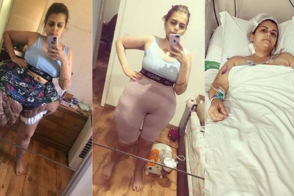 karina-rodini-03012023123338813-599x400 Médicos brasileiros retiram quase 35 kg de tumor de mulher com doença rara: 'Salvou a vida dela'