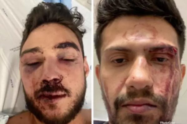 casal_gay_agredido_boate_portugal-599x400 Casal gay de brasileiros é espancado em boate de Portugal: "Me torturaram"
