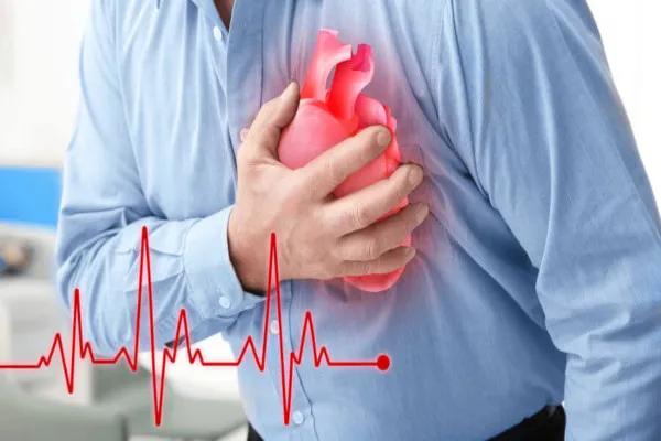 1-infarto-do-miocardio Casos de infarto aumentam 25% no Brasil, em seis anos