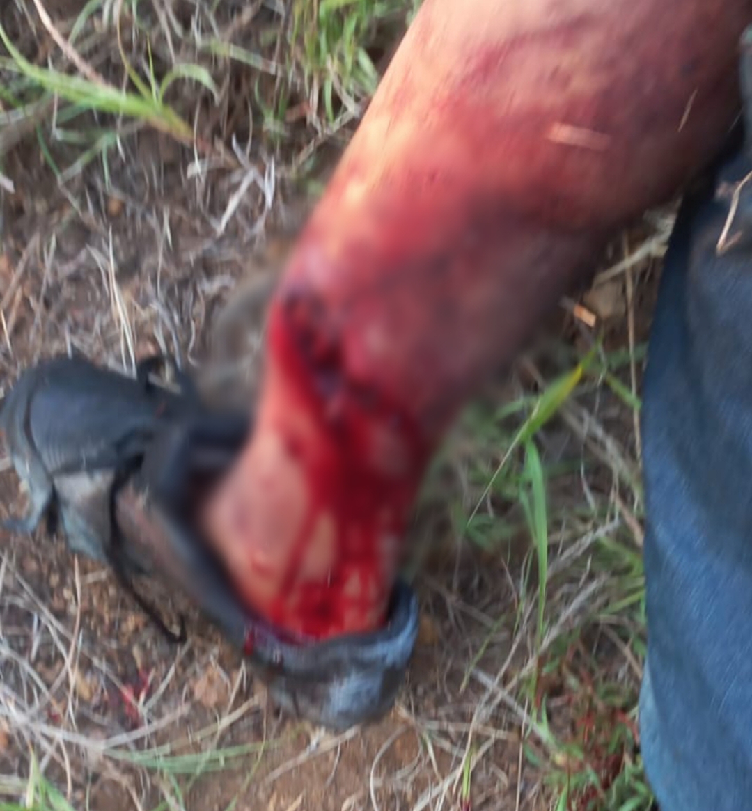 Point-Blur_Sep042023_183643 Colisão entre motocicleta e carro deixa uma pessoa ferida na PB que liga os municípios de Sumé e Congo