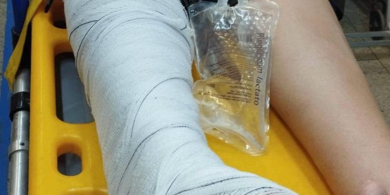 WhatsApp-Image-2023-10-22-at-09.33.20-800x400-1 Acidente na manhã de domingo deixa mulher com fratura no fêmur na saida de Monteiro para Sumé