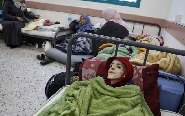 WhatsApp-Image-2024-03-10-at-08.06.26 Menino palestino morre com desnutrição grave e em meio a falta de remédios em Gaza